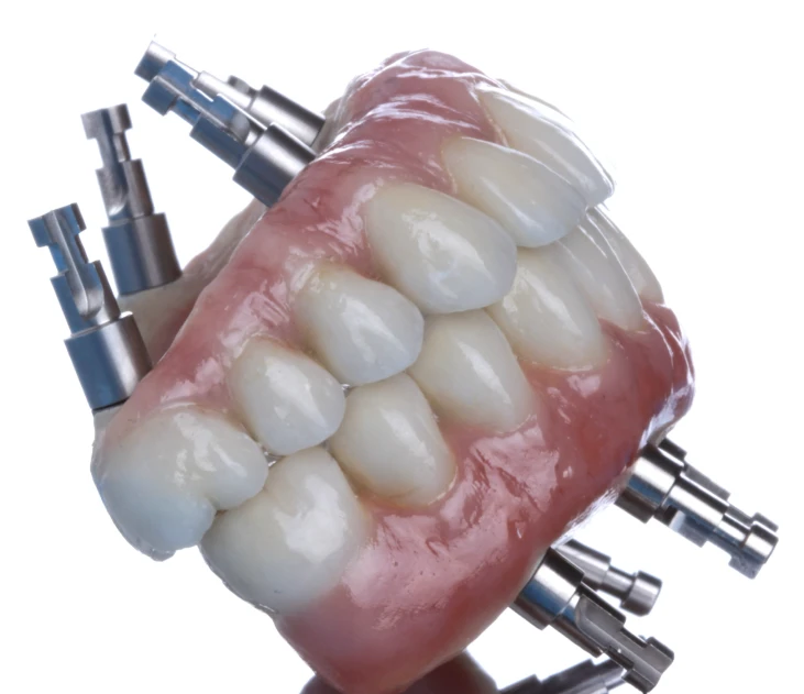 Full Arch Protocol (All-on-X)